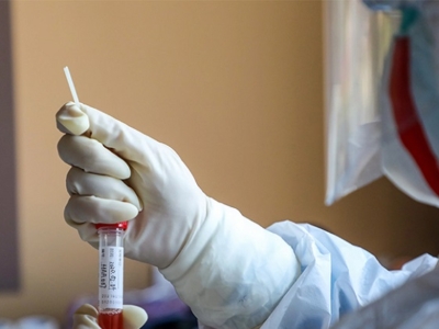 Actu-2020-03-Impact COVID